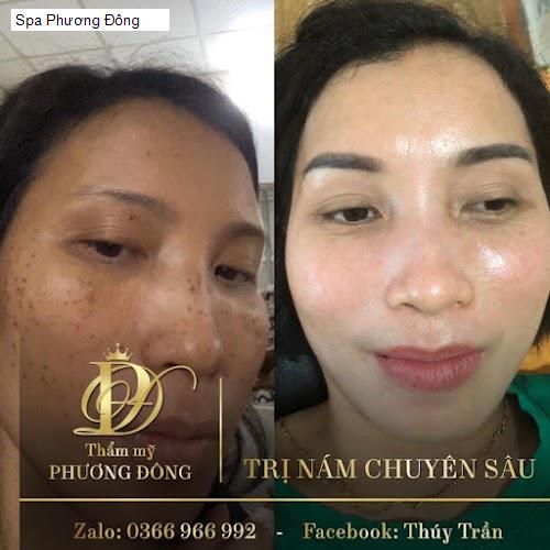 Bảng giá Spa Phương Đông