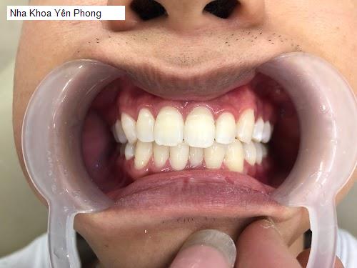 Hình ảnh Nha Khoa Yên Phong
