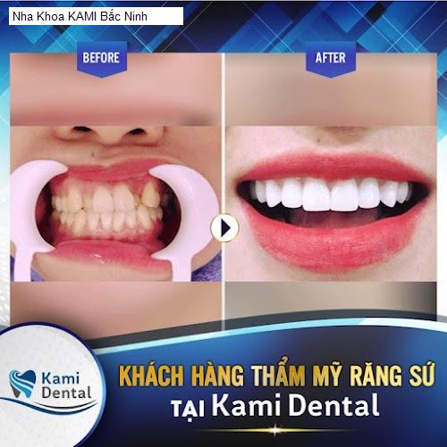 Hình ảnh Nha Khoa KAMI Bắc Ninh