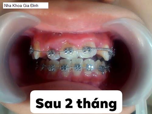 Hình ảnh Nha Khoa Gia Đình